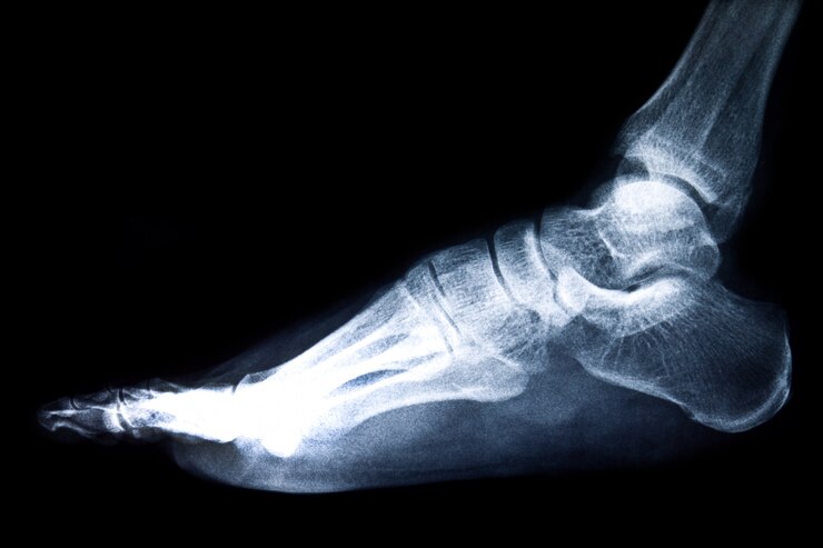 La anatomía del pie y sus problemas comunes. Consulta con un podólogo